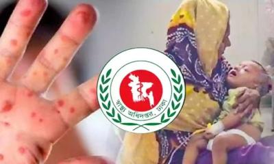 হাম ও উপসর্গে আরও ৮ শিশুর মৃত্যু, উদ্বেগ বাড়ছে