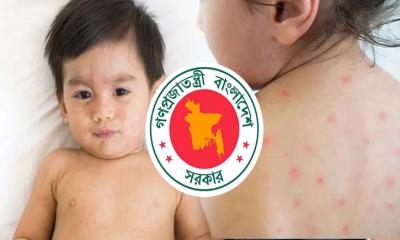 দেশে হামের উপসর্গে আরও ৬ শিশুর মৃত্যু, প্রাণহানি ছাড়াল ৭০০